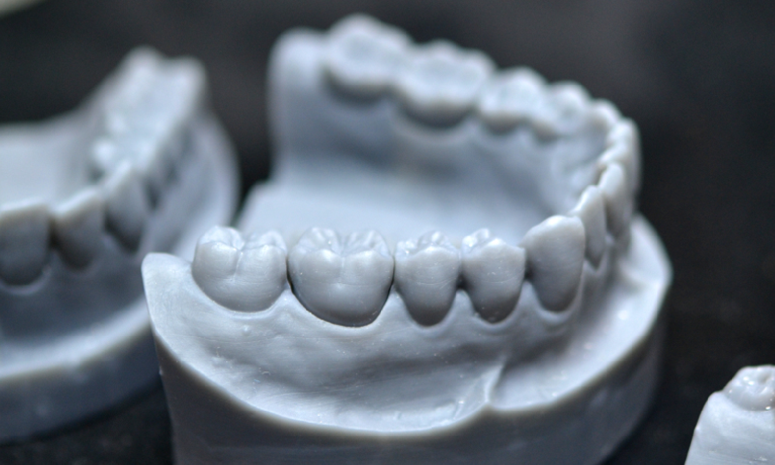 substituicao-de-modelo-de-gesso-por-escaneamento-intraoral-e-impressao-3d